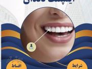ایمپلنت دندان در مشهد با اقساط بلند مدت، بدون پیش پرداخت ( دیگه نگران هزینه‌ها نباش )