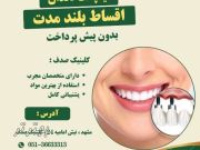 ایمپلنت دندان با کیفیت بالا و پرداخت اقساطی در کلینیک صدف