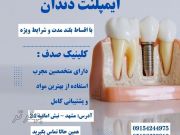 کاشت ایمپلنت بدون فشار مالی با اقساط بلند مدت